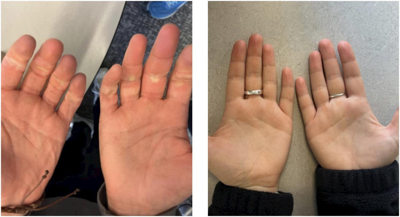 Hands after a moving day